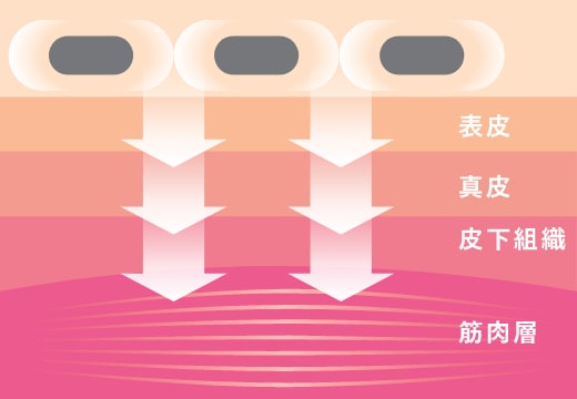 EMSのイメージ画像