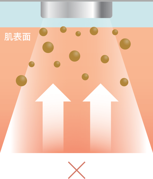 イオン導出のイメージ図
