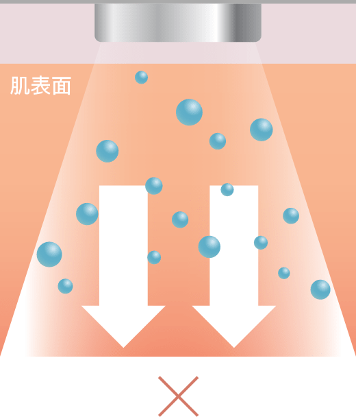 イオン導入のイメージ図