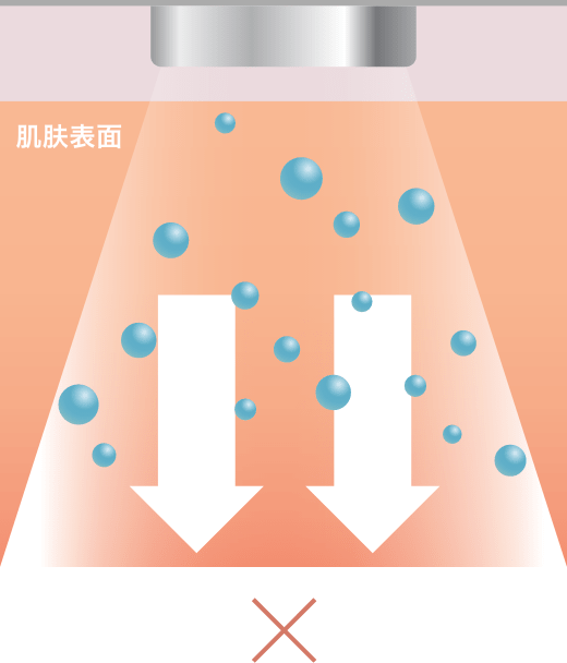 离子导入